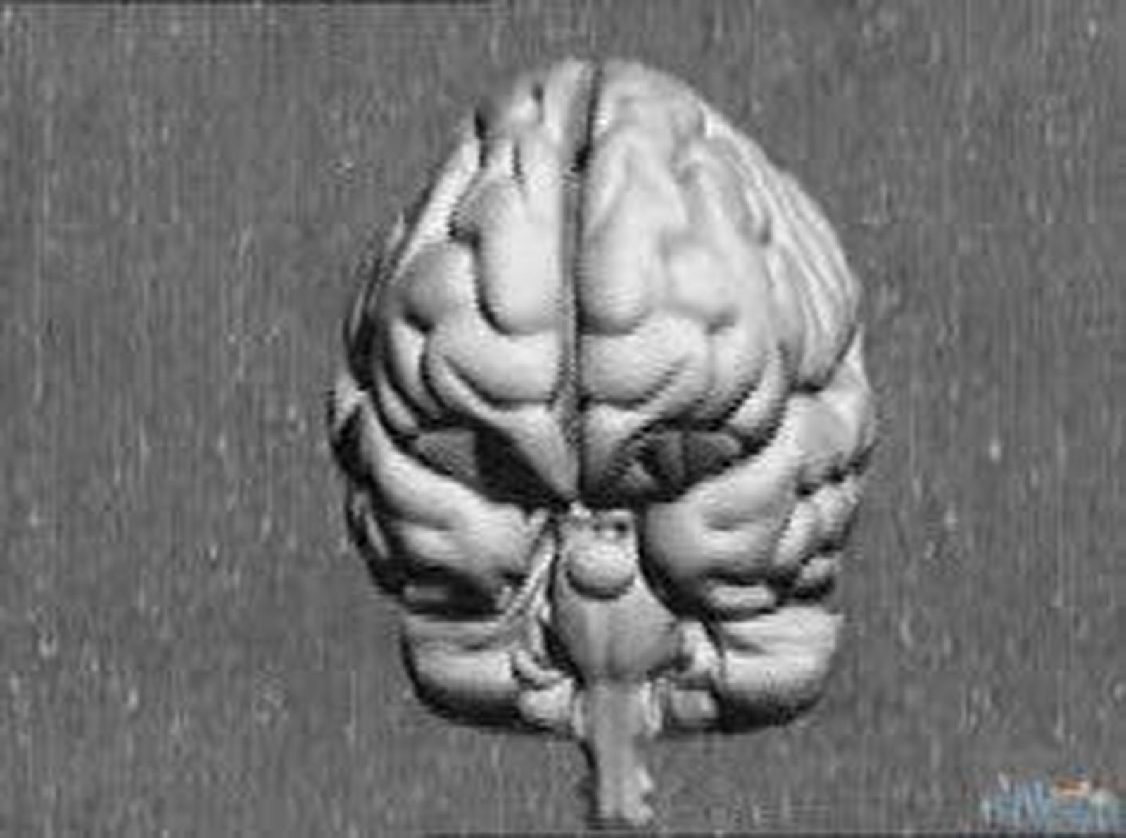 Un mapa en 3D del cerebro para trazar la ruta del Alzheimer