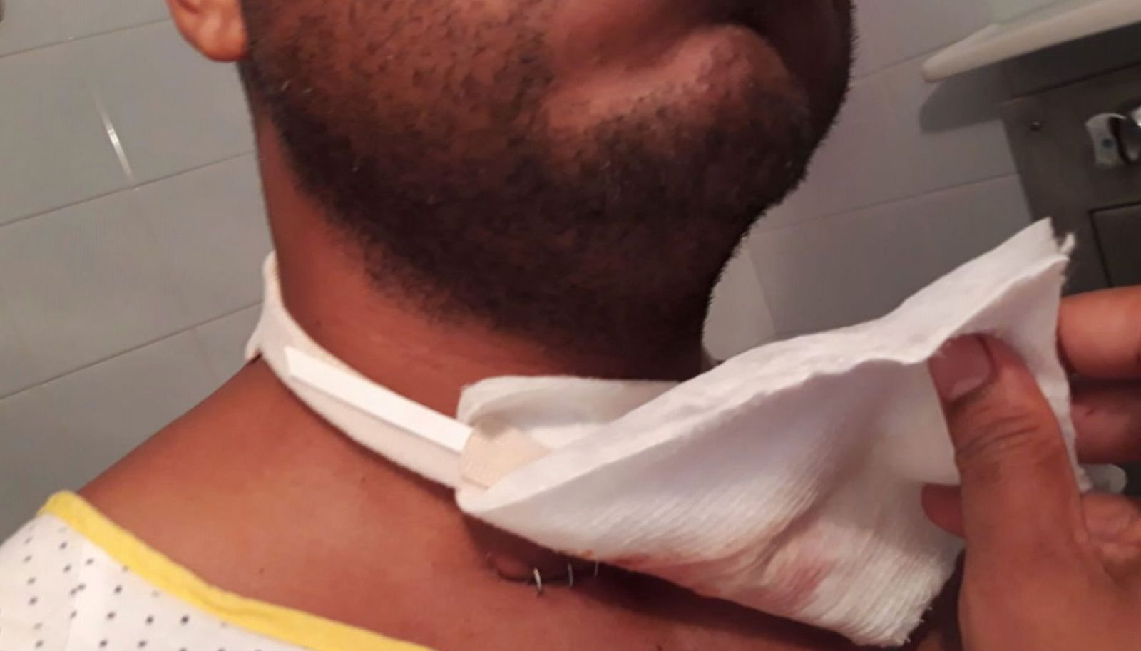 Un hombre intenta degollar a su expareja: "Me dijo que si no era para él, no sería para nadie"