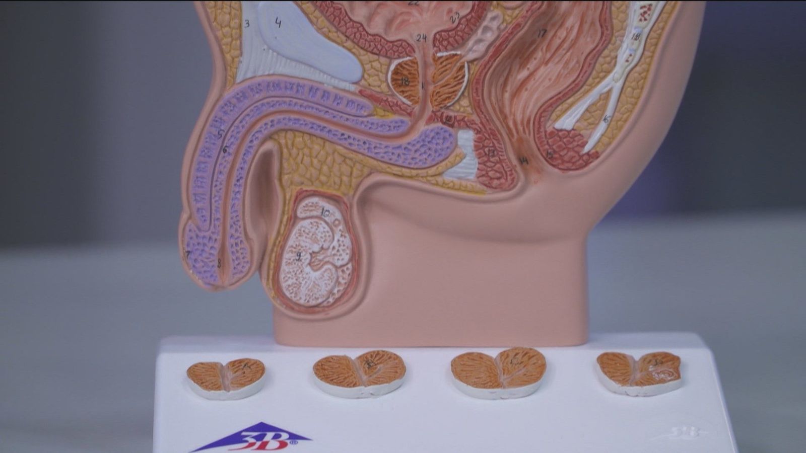 El Hospital La Paz sensibiliza sobre el cáncer de próstata