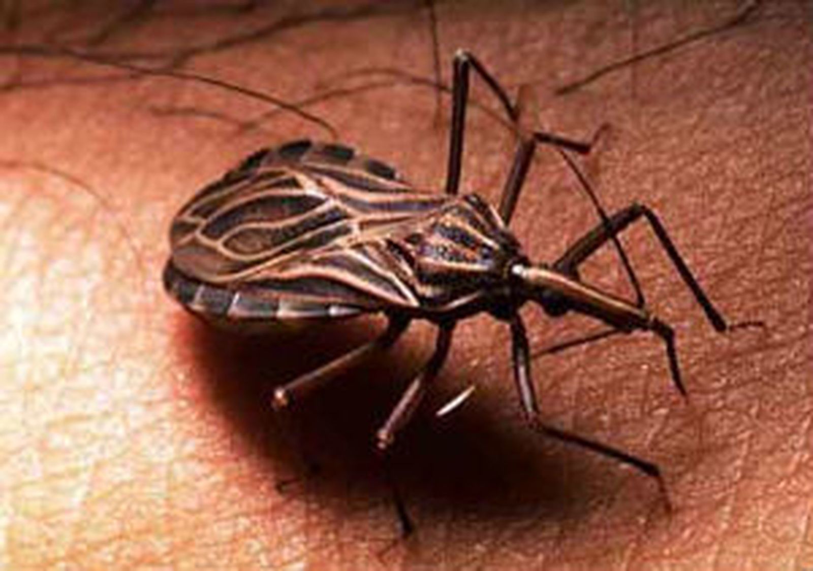 Chagas