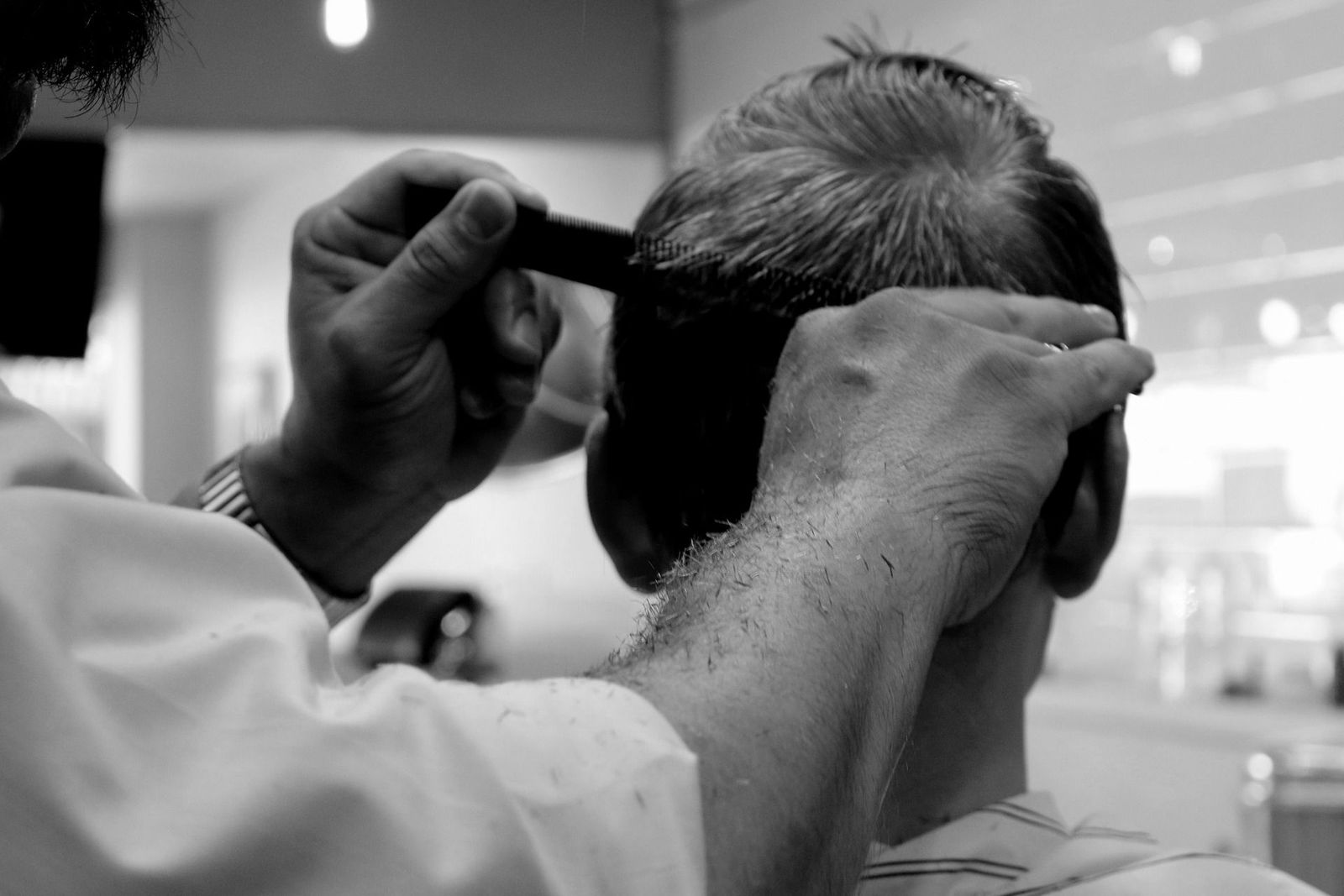 El trasplante capilar no cura la alopecia
