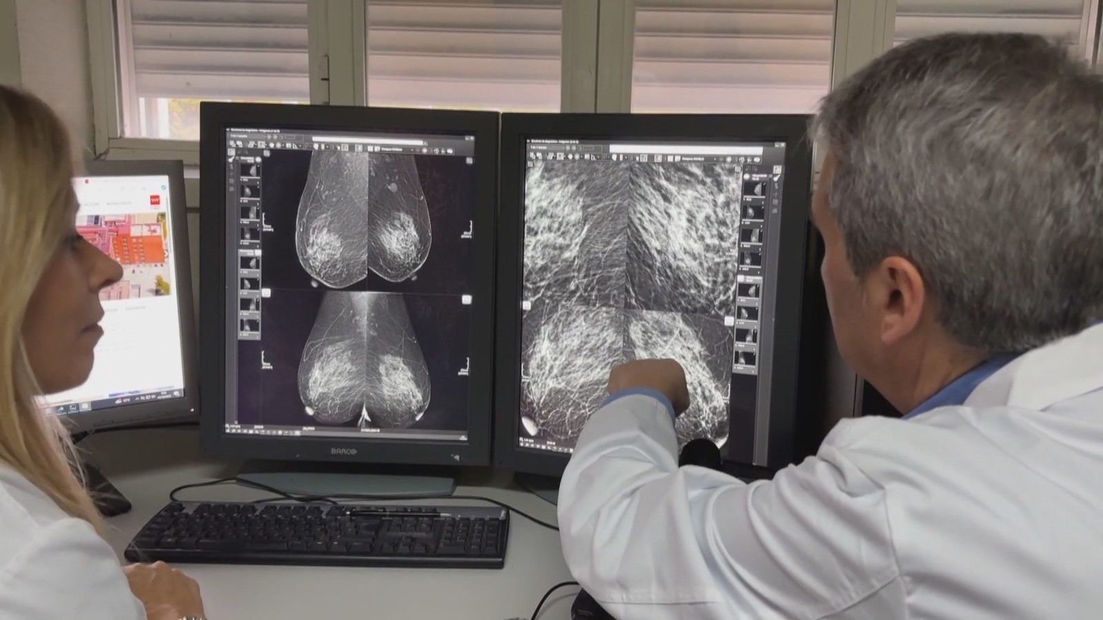 La Fiscalía andaluza no ve indicios de delito contra aforados en los cribados del cáncer