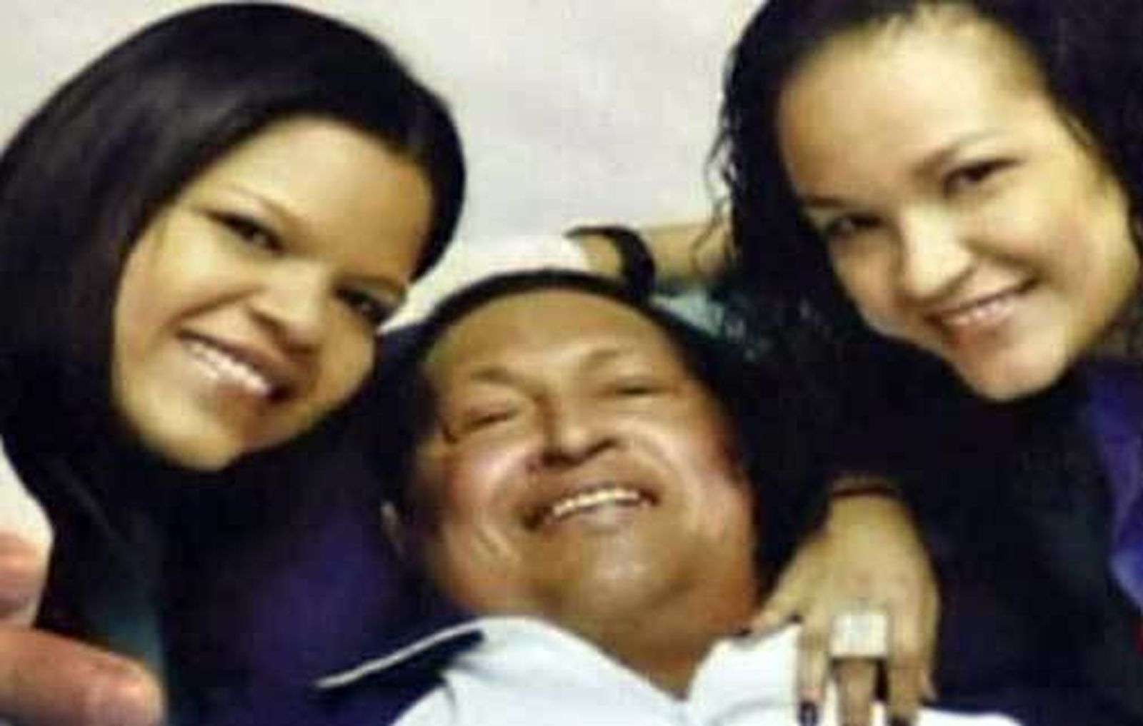 Chávez respira a través de una cánula traqueal