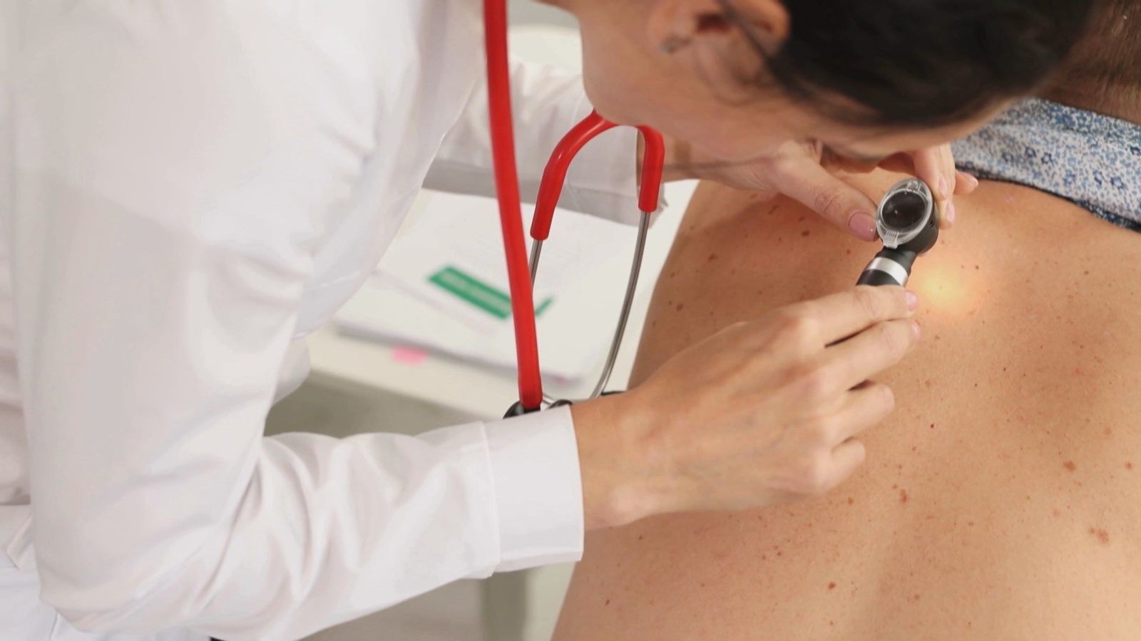 Fotoprotección y diagnóstico precoz, claves contra el cáncer de piel