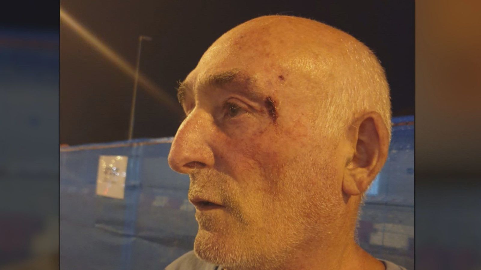 Agreden a un matrimonio de Orcasur por pedir que dejen de orinar en la puerta de su casa