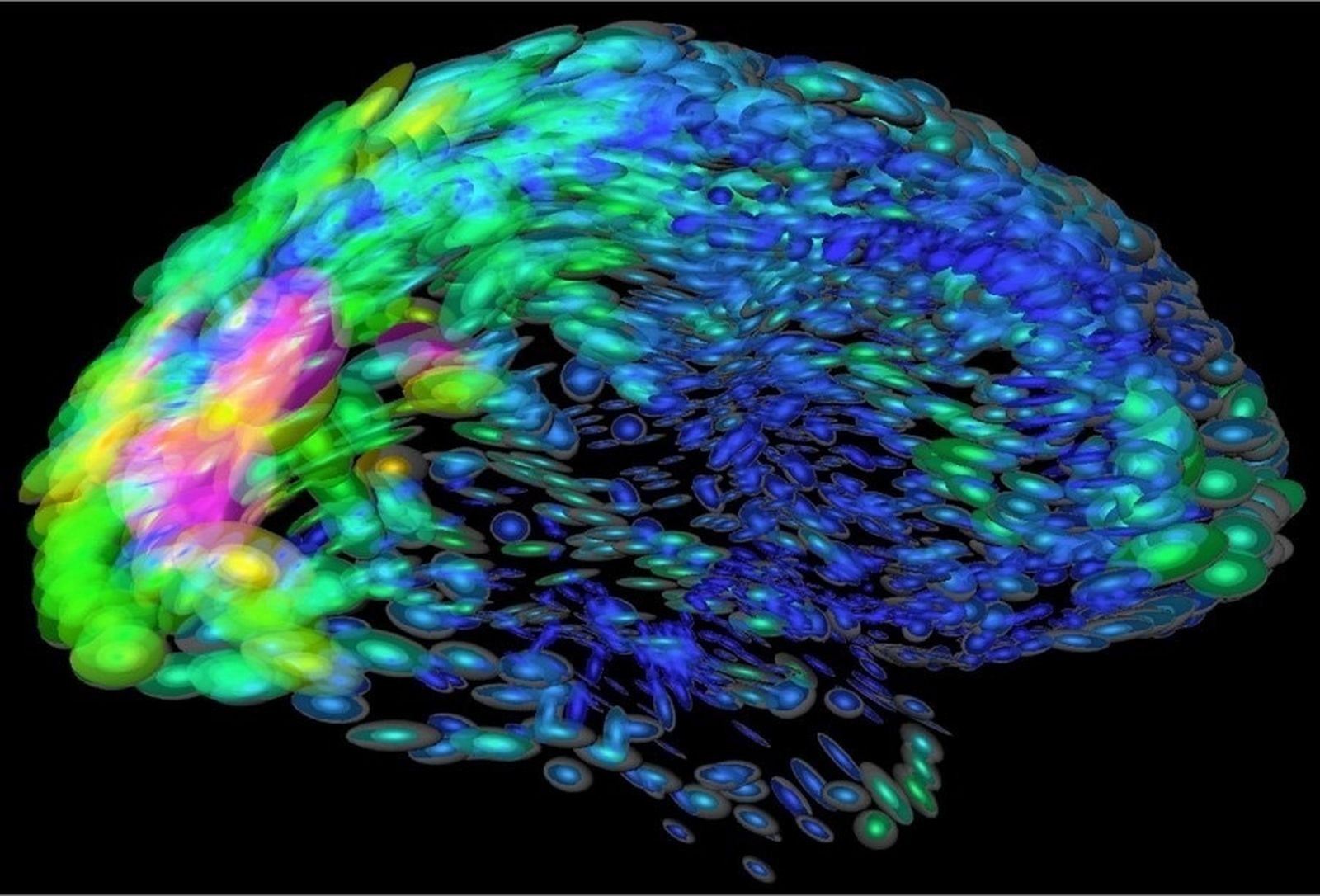 Imagen del cerebro que muestra en distintos colores las regiones con diferentes funciones.
