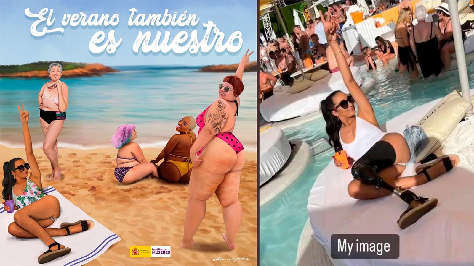 Sian, modelo de la polémica campaña de Igualdad a la que han 'borrado' su pierna ortopédica: "No puedo explicar la cantidad de ira que siento en este momento"