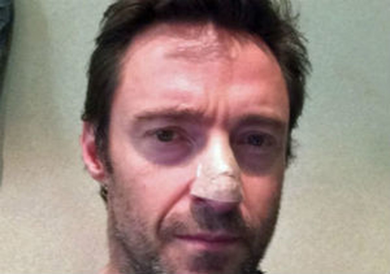 Hugh Jackman