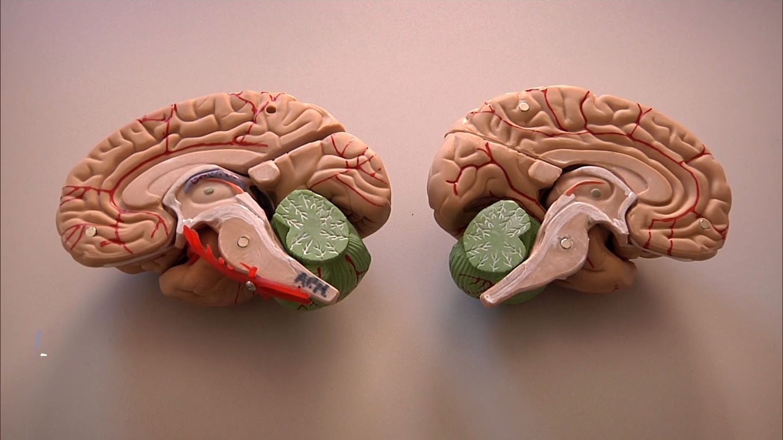 Cefaleas y migrañas: claves para entender uno de los dolores más comunes