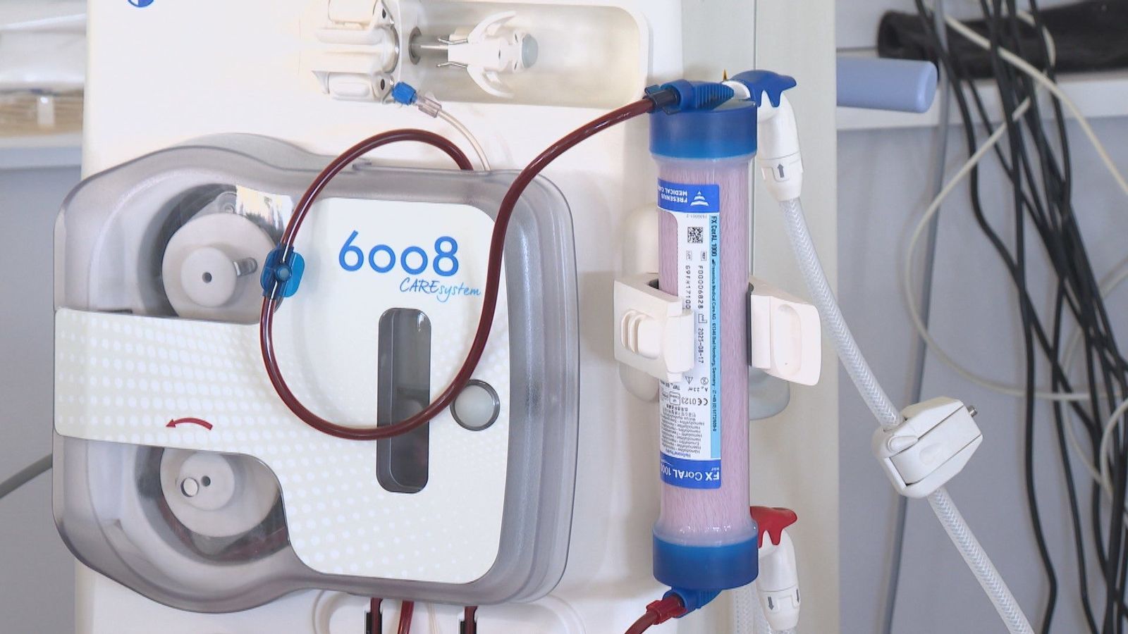 La Unidad de Diálisis del Hospital Infanta Sofía aumenta un 75% su capacidad para pacientes crónicos renales