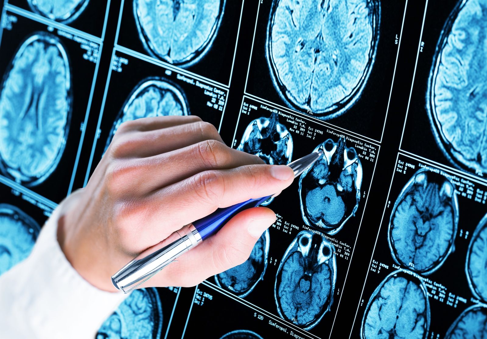 Imagen de distintas zonas de un cerebro