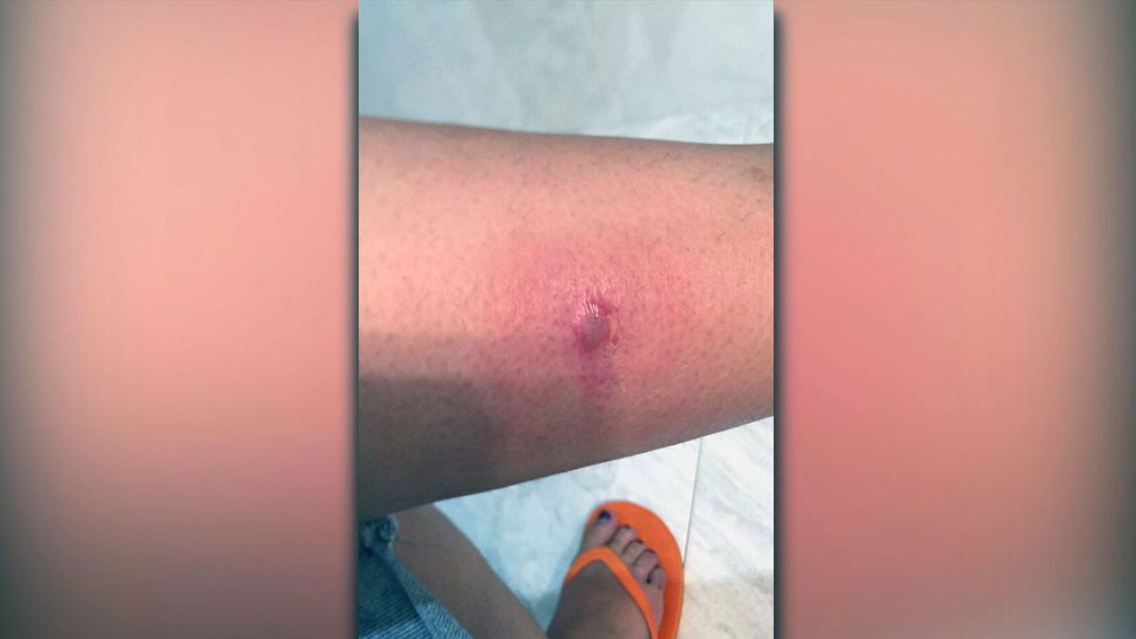 Invasión de mosquitos en el Hospital de La Princesa