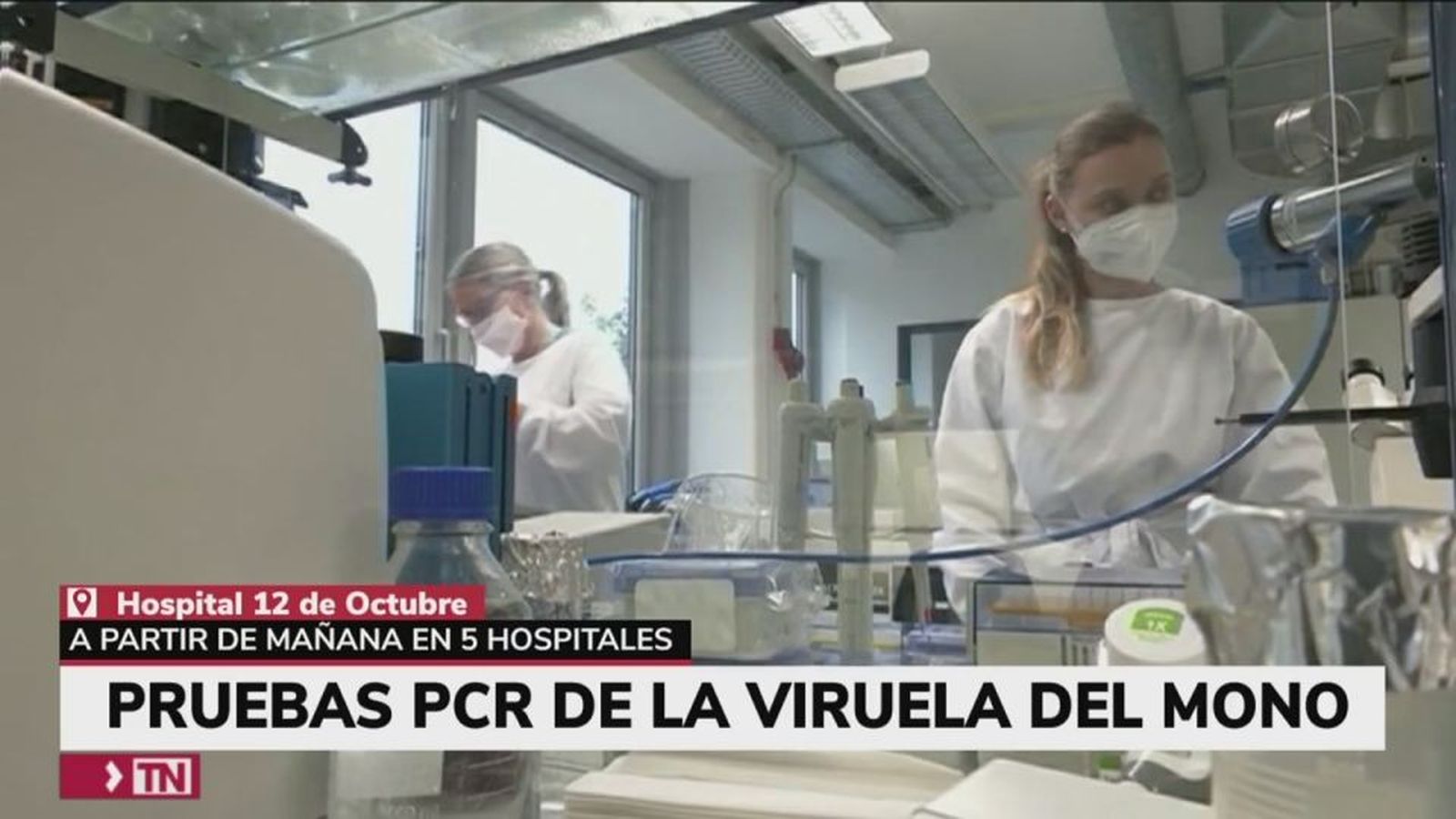 75 casos de viruela del mono en Madrid y otros 46 sospechosos