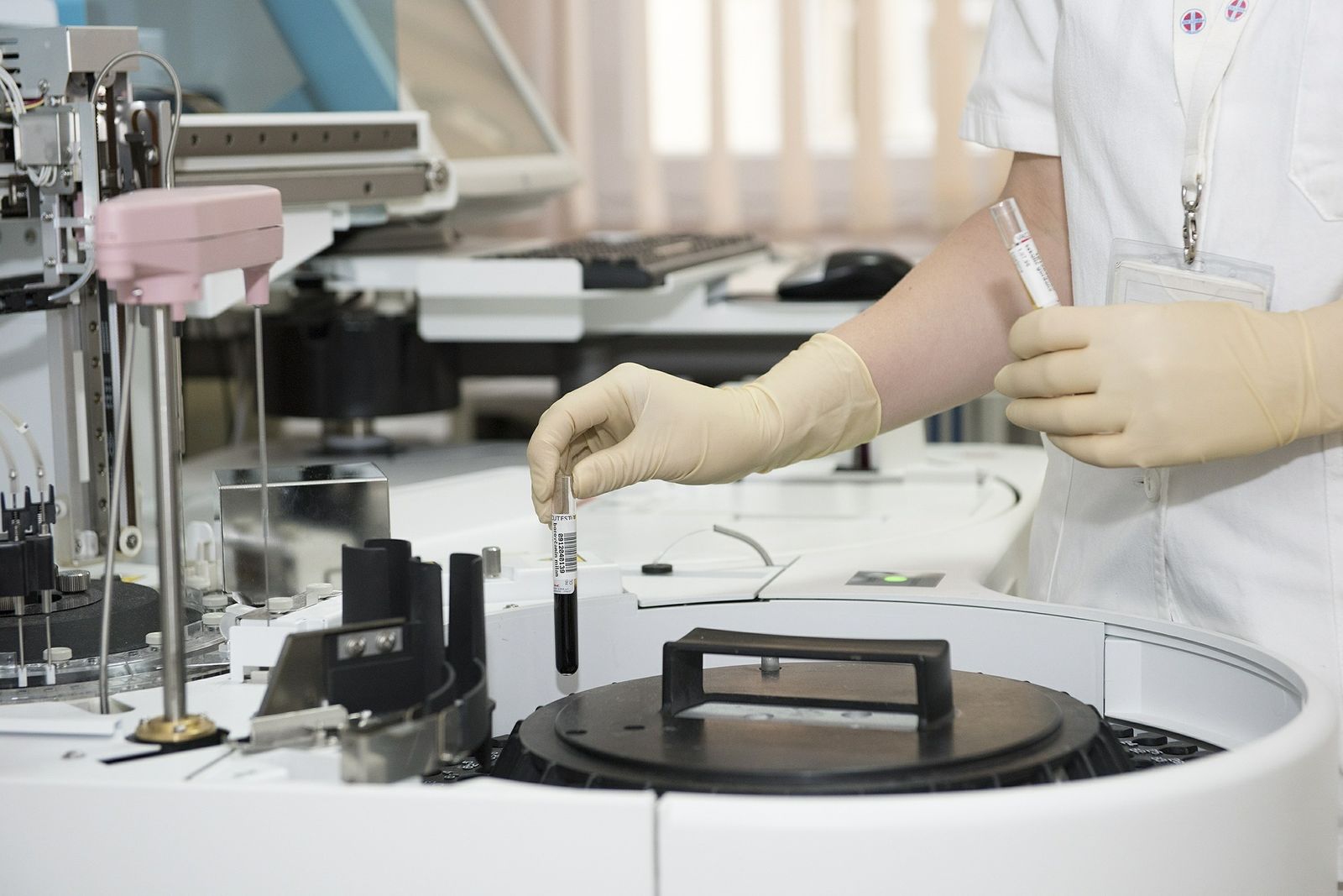 La clave contra la leucemia mieloide aguda podría estar en los antihistamínicos