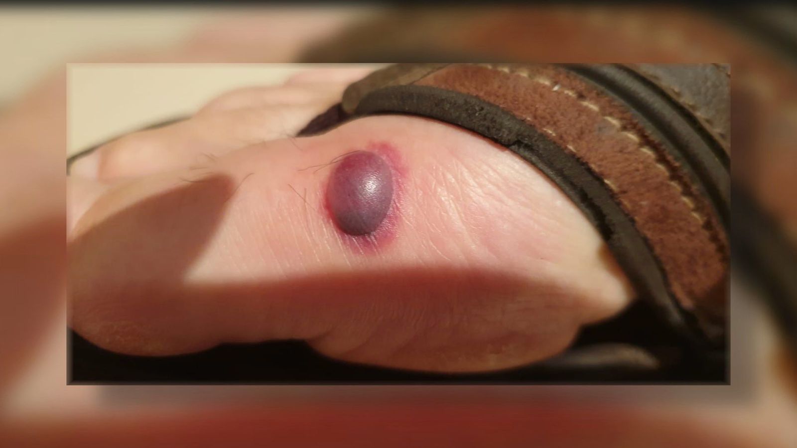 Funcionarios de prisiones denuncian una plaga de chinches en la cárcel de Valdemoro