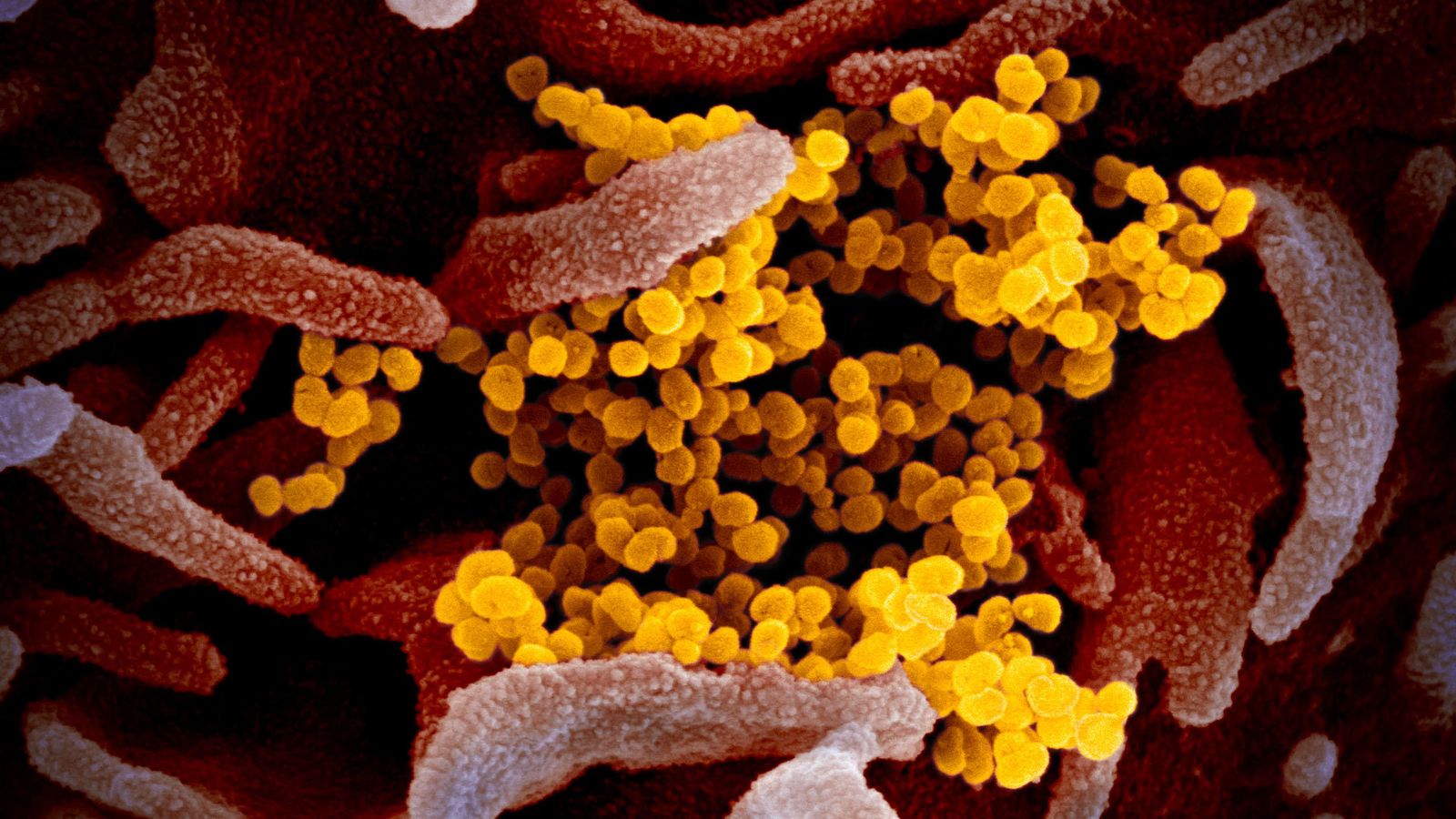 Imagen microscópica del SARS-CoV-2, el virus causante de la enfermedad covid-19, tomada por el Instituto estadounidense de Alergia y Enfermedades Infecciosas (NIAID)