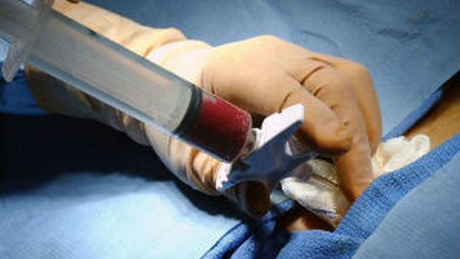 Sanidad lanza una campaña para buscar  donantes de  médula