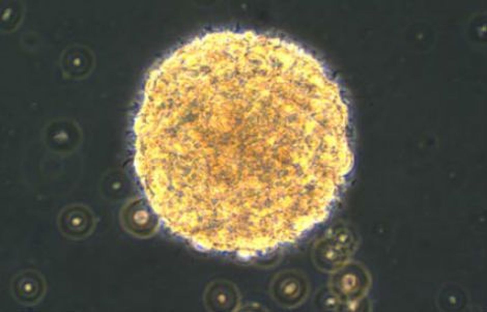 Hallan una proteína que elimina las células malignas de un tumor cerebral
