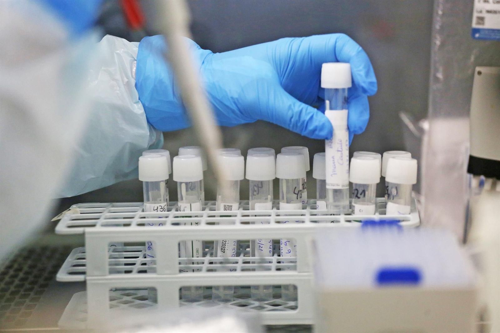 Hepatitis infantil aguda: ¿Qué es y qué casos hay en España?