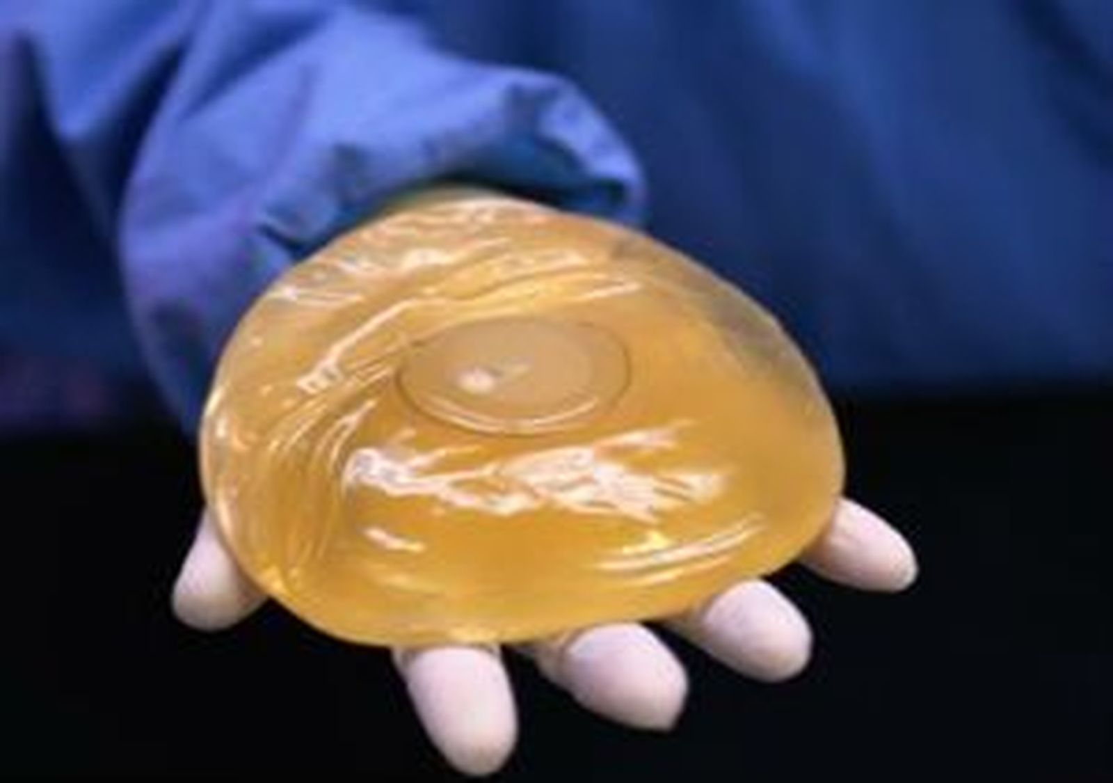 Un juzgado madrileño condena a un cirujano y una clínica de estética por un implante mamario PIP