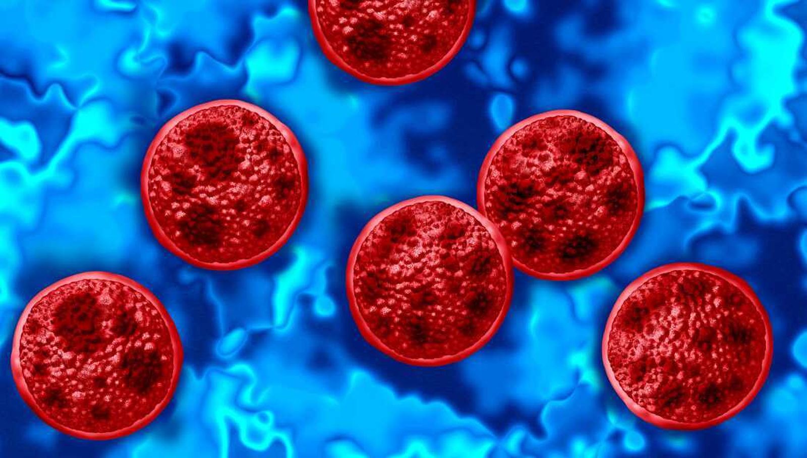 Ciclosporiasis