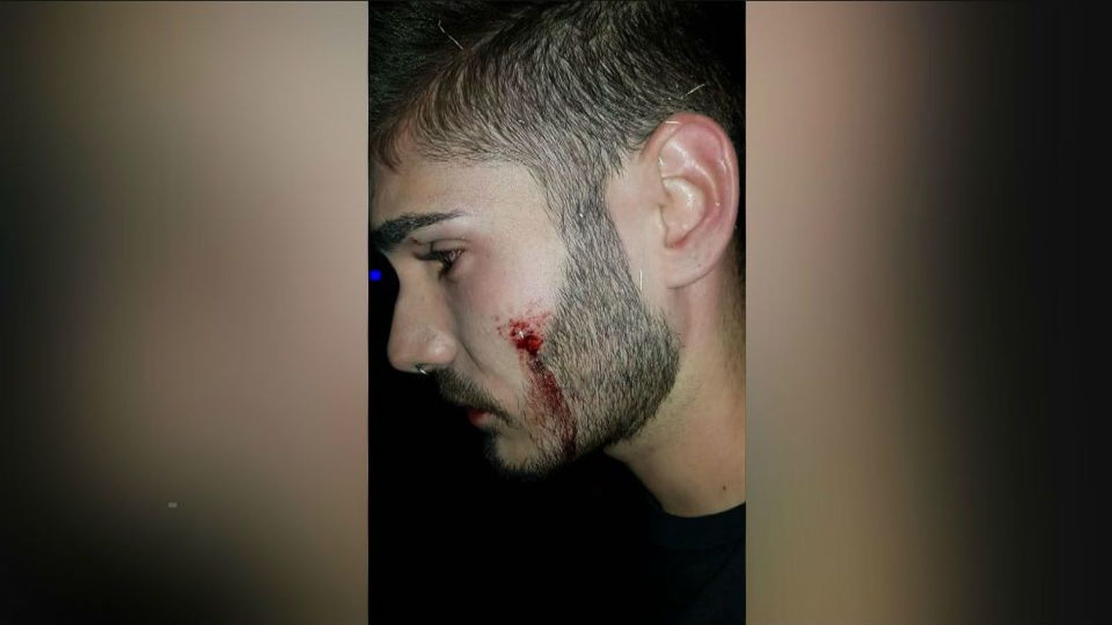 Nueva agresión homófoba a un joven en una discoteca de Alcorcón