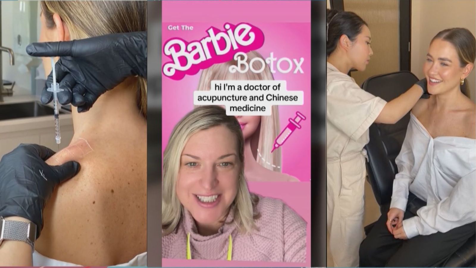Barbie bótox: la nueva peligrosa tendencia de lucir hombros de muñeca