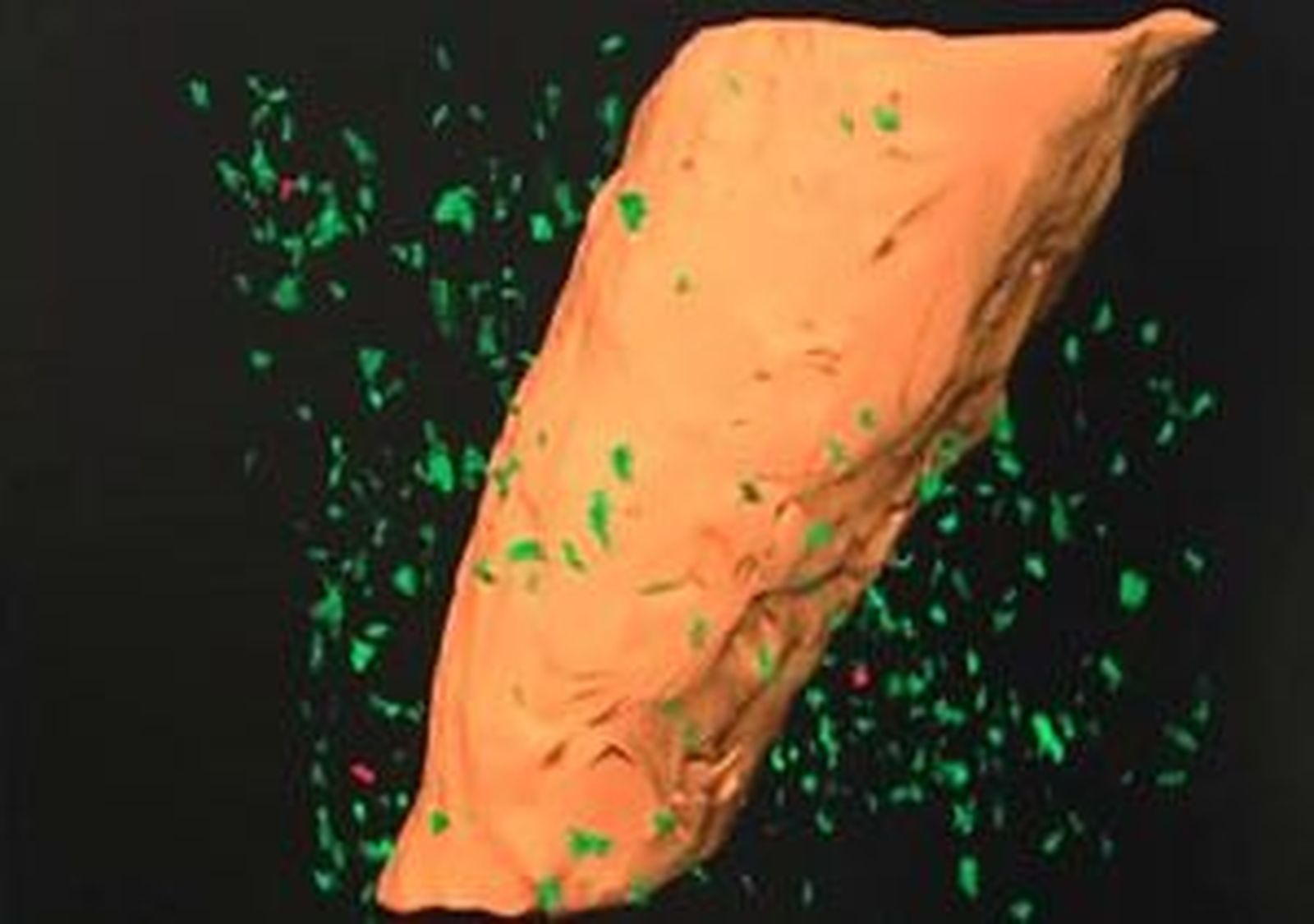 Mapas microscópicos del cerebro permitirán buscar fármacos para el alzhéimer