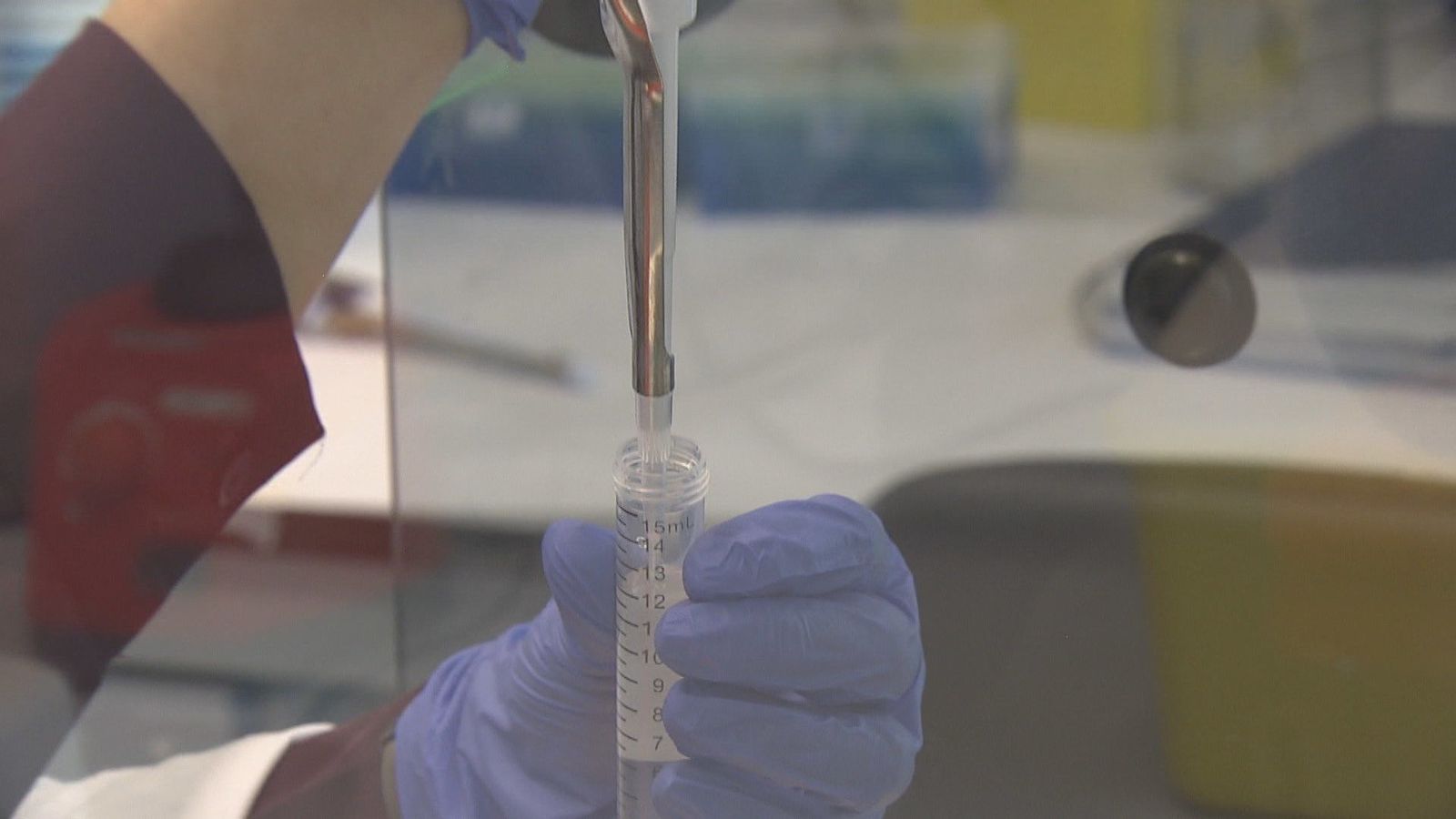 La biopsia líquida avanza como clave para diagnosticar el cáncer