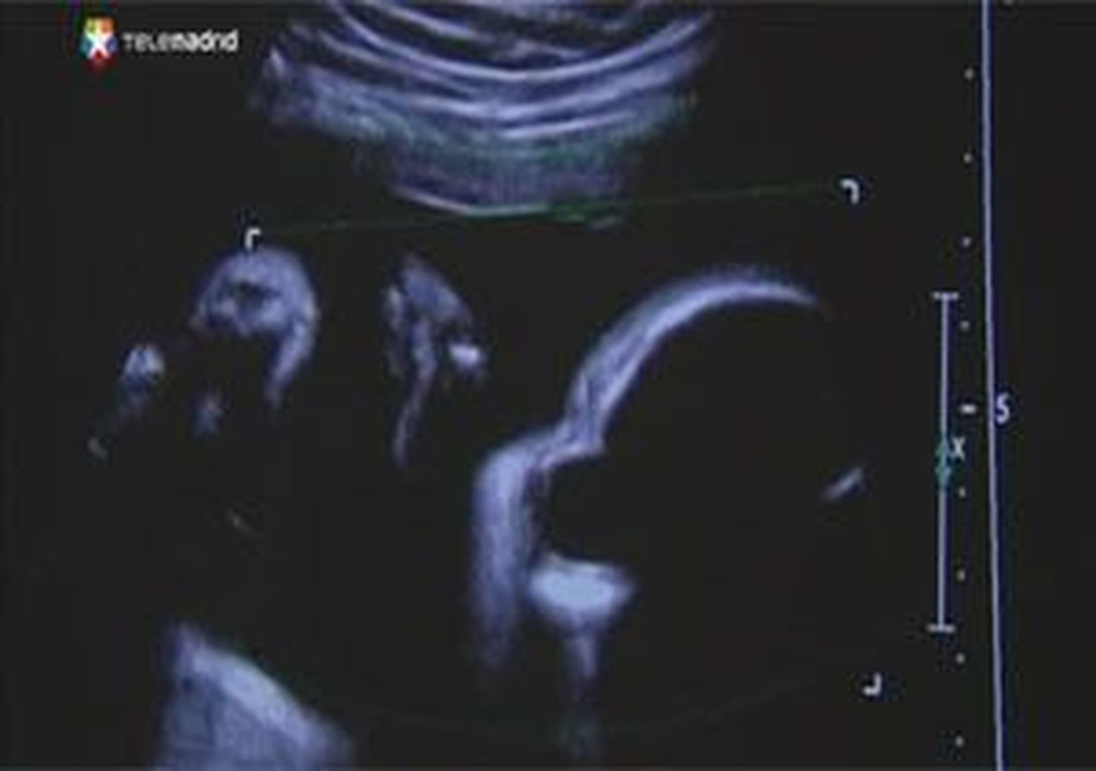 Los médicos y grupos pro vida se muestran satisfechos con las reformas del aborto