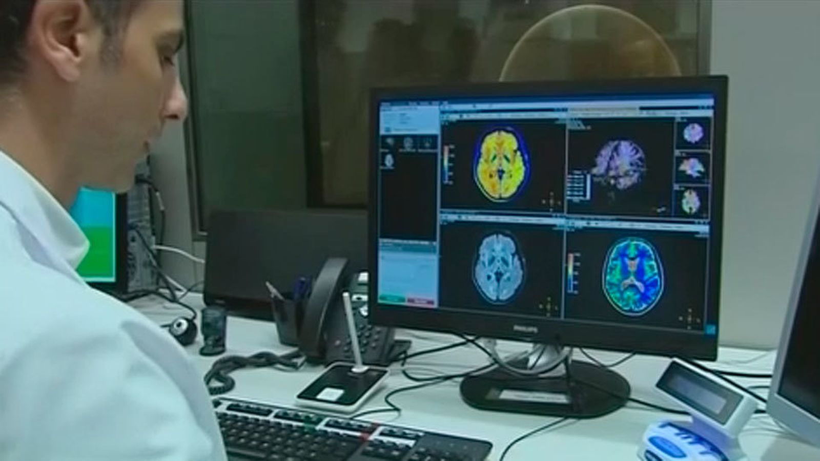 Estudio de la Fundación Maragall para conocer 5 años antes si hay riesgo de alzheimer