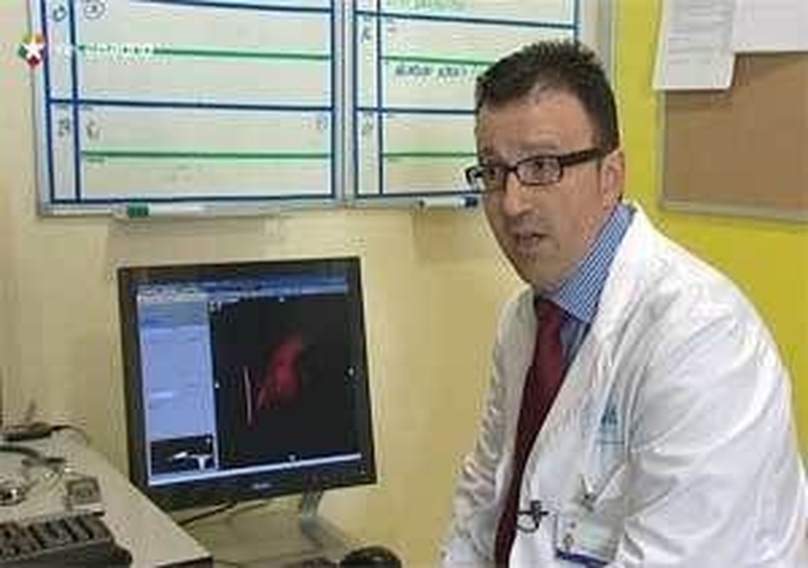El Hospital de Torrejón usa la navegación 3D para localizar y tratar arritmias complejas