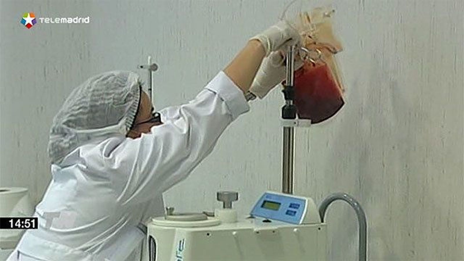 La sangre del cordón umbilical puede erradicar el VIH en pacientes con cáncer