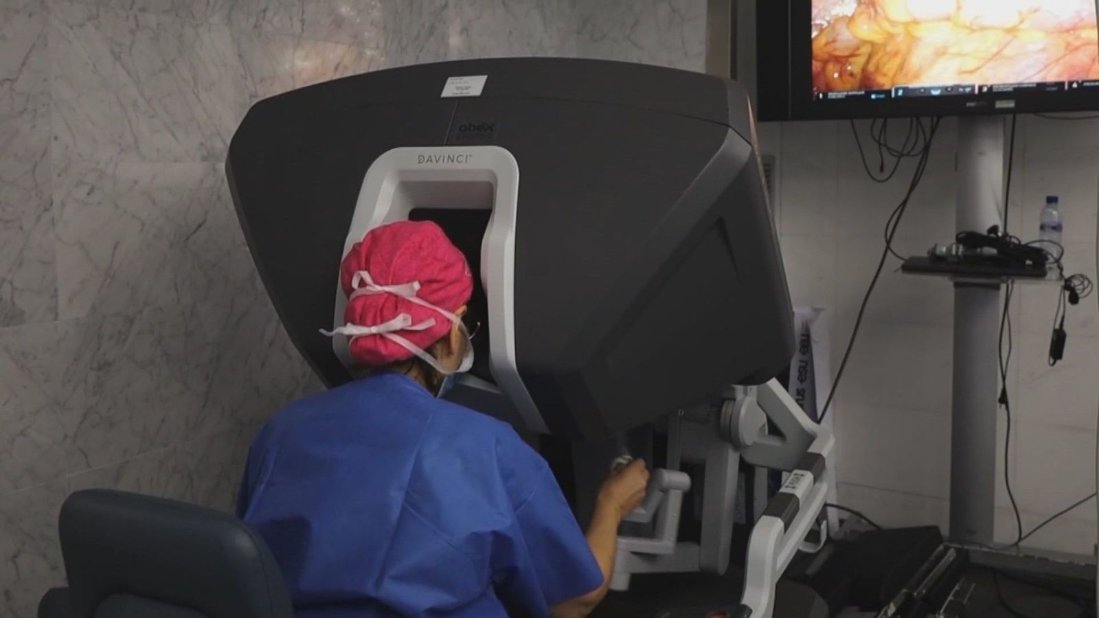 Primera transposición de útero en España a una paciente con cáncer para proteger su fertilidad