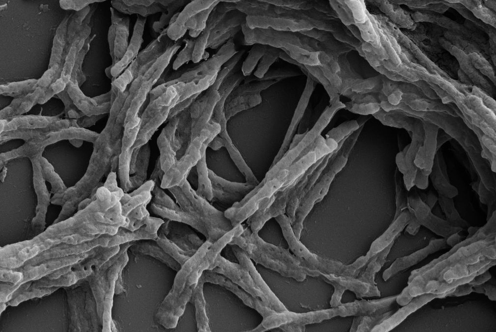 Mycobacterium smegmatis