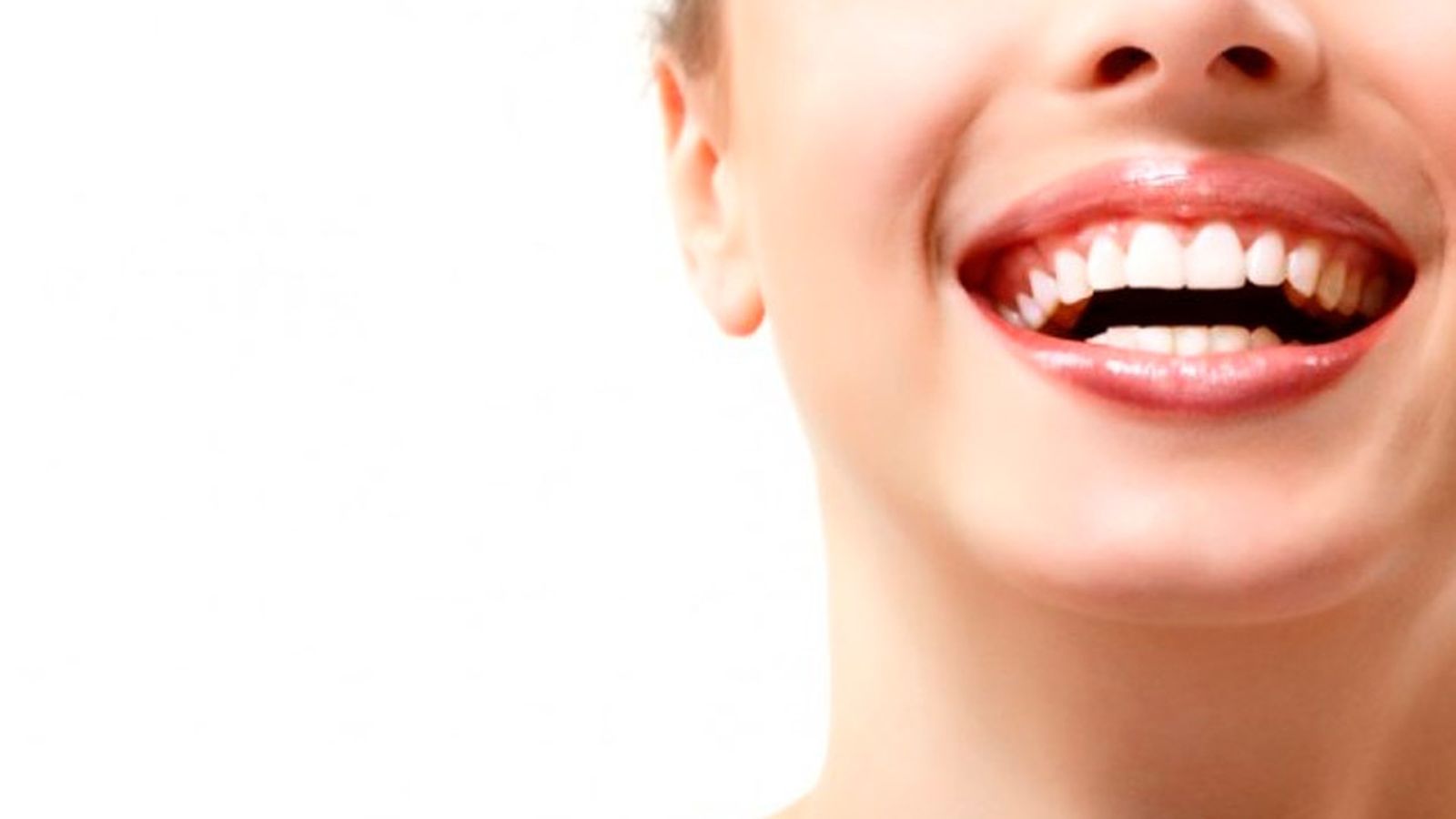 Blanquear los dientes, un tratamiento cada vez más común