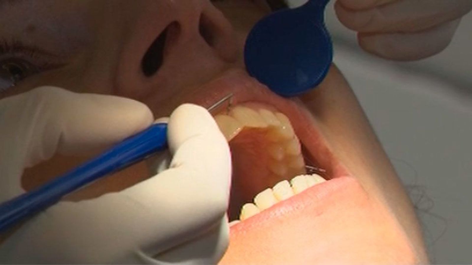 Abre en Madrid la "Casa de las Encías" para fomentar la salud bucodental