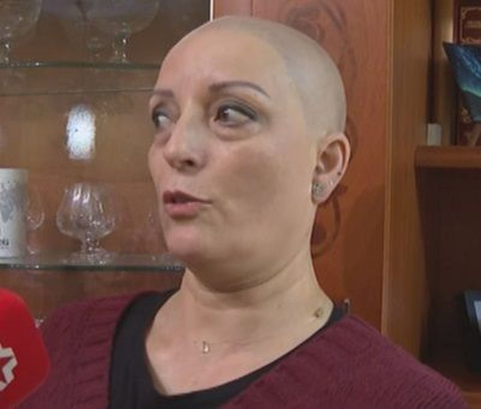 La Asociación Madrileña de Alopecia lucha contra el estigma de ser calva