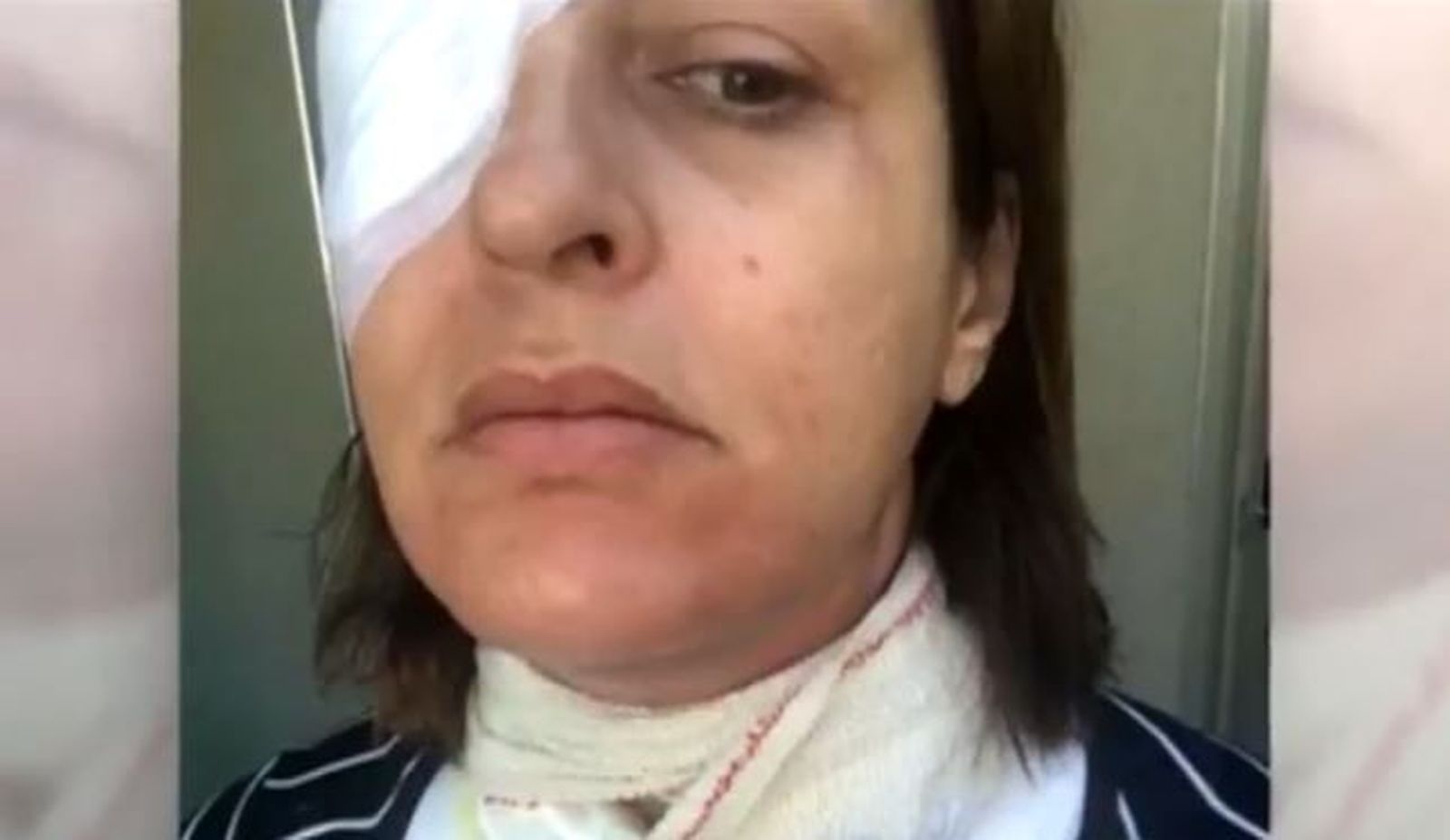 Dos mujeres denuncian graves quemaduras por la explosión de un robot de cocina