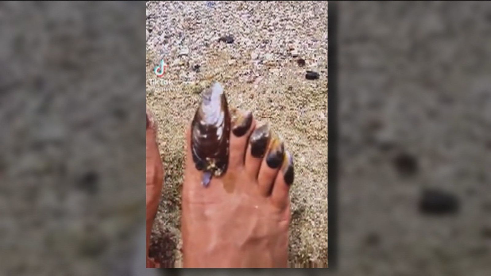 Por qué las uñas de los pies se hacen más gruesas con la edad