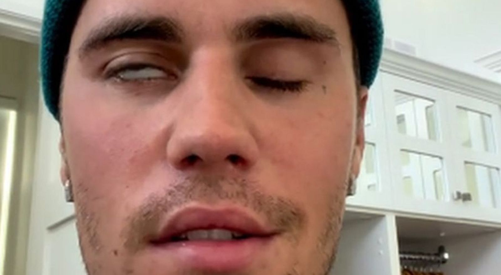 Justin Bieber sufre una parálisis facial parcial y aplaza sus conciertos