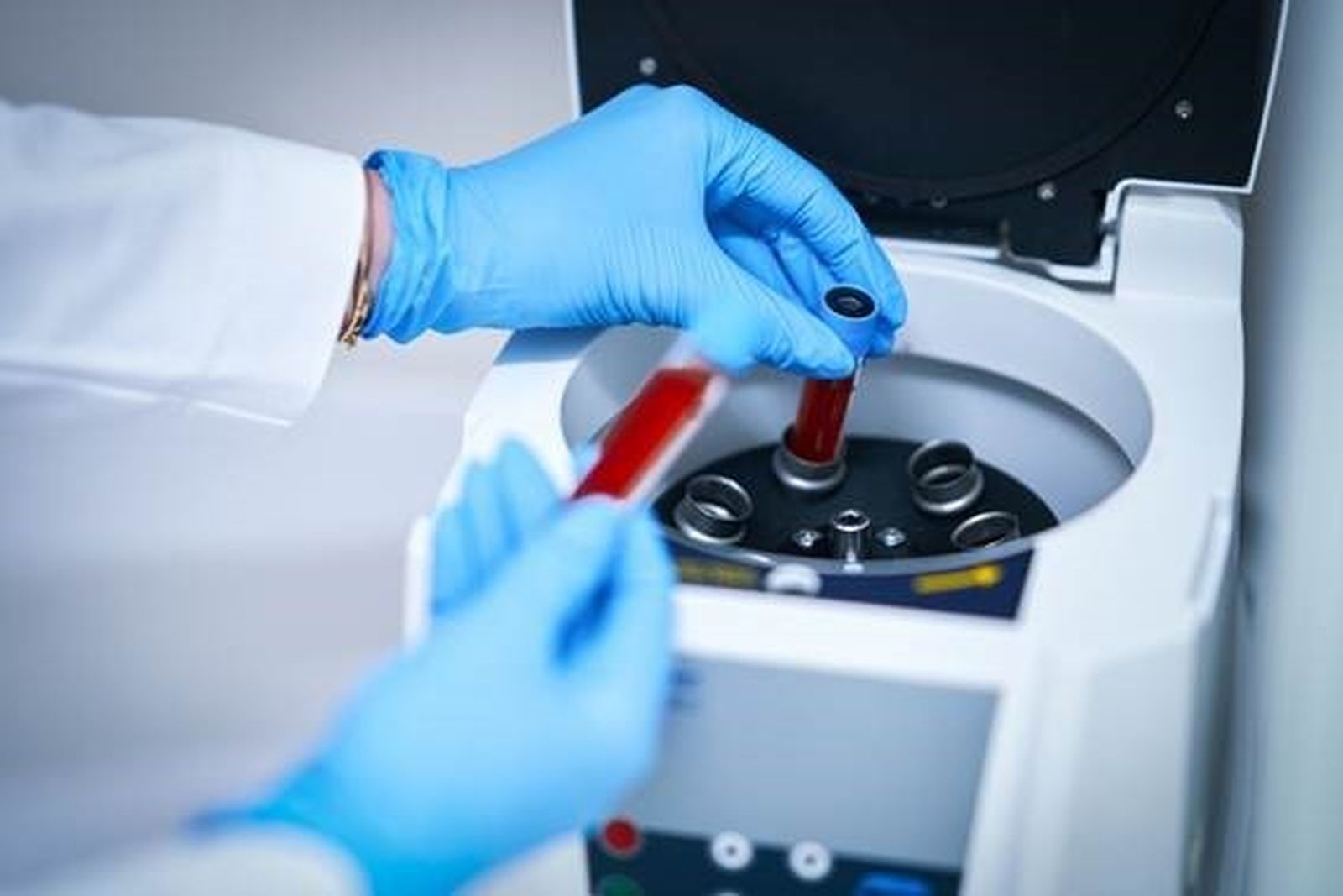 Tubos con muestras de sangre en una centrifugadora