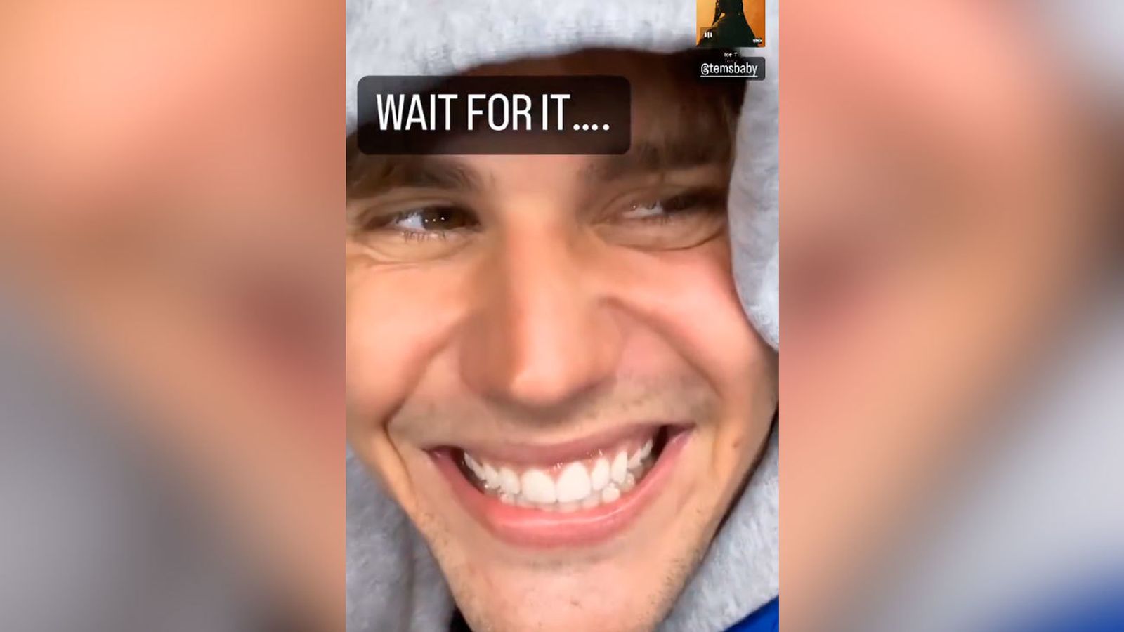 Justin Bieber se recupera de su parálisis cerebral