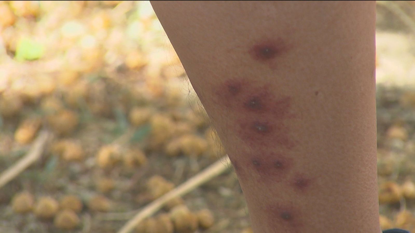Vuelven las dolorosas mordeduras de la mosca negra a los barrios madrileños del Manzanares