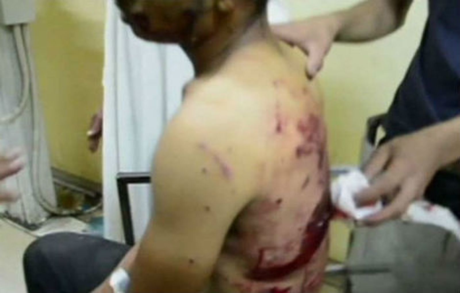 Al menos 24 heridos por explosión frente a una comisaría de policía en Egipto